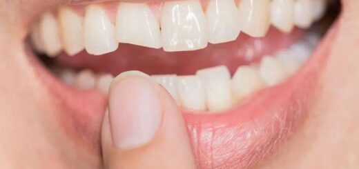 Some of the Most Effective Treatments & Procedures for Cracked Teeth
