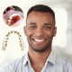Why Discreet Ceramic Braces Are Winning Over Adult Patients